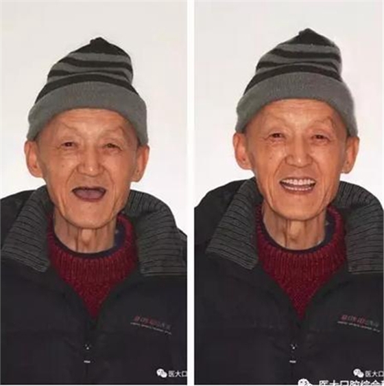 醫(yī)大口腔綜合科 |&ldquo;鑲牙&rdquo;的學(xué)問&mdash;&mdash;活動類 