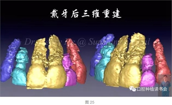 2017口腔醫(yī)師口腔組織病理之牙齦病 2017口腔醫(yī)師口腔組織病理之牙齦病