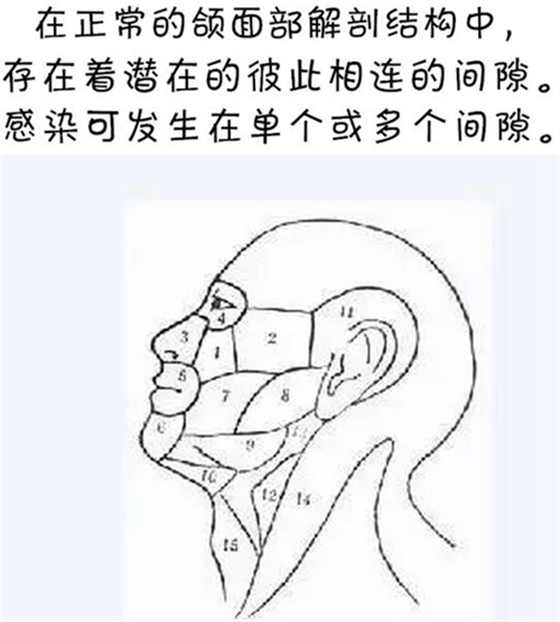 警惕！牙疼引發(fā)的間隙感染很危險