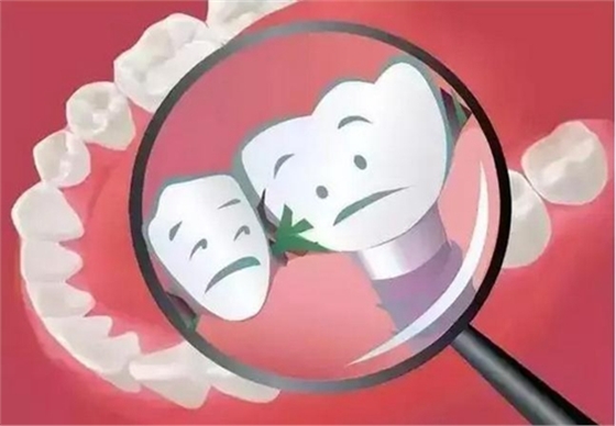 為什么吃東西老塞牙？小心這些病！  