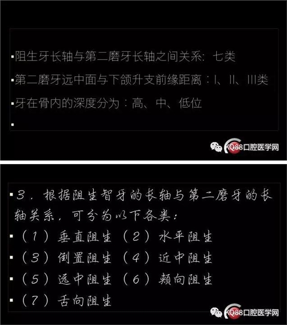 智齒拔除 智齒拔除