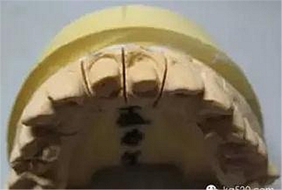 義齒加工技師想對醫(yī)生說的話 義齒加工技師想對醫(yī)生說的話