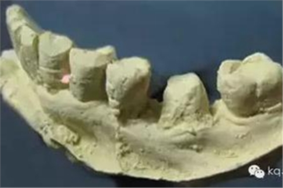 義齒加工技師想對醫(yī)生說的話 義齒加工技師想對醫(yī)生說的話