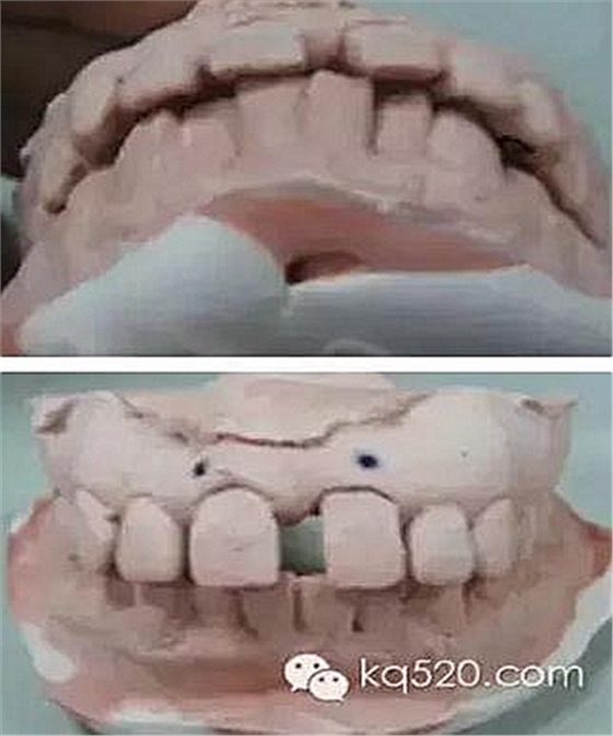 義齒加工技師想對醫(yī)生說的話 義齒加工技師想對醫(yī)生說的話