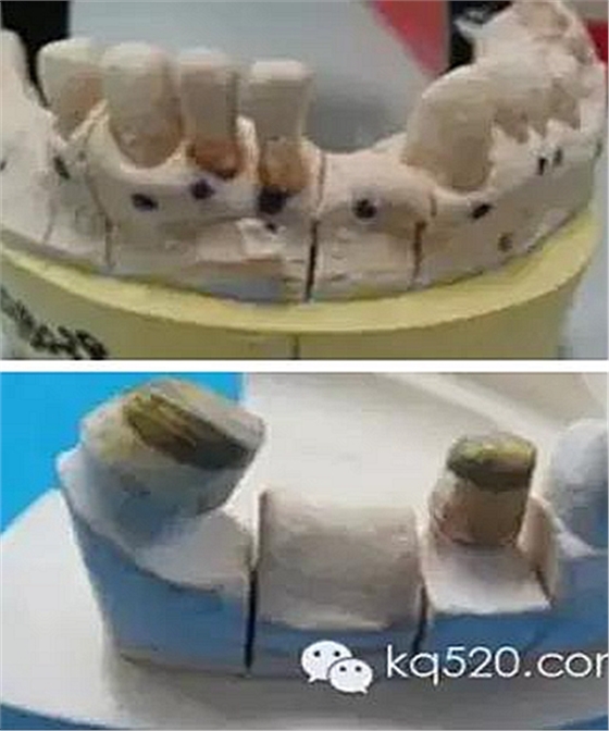 義齒加工技師想對醫(yī)生說的話 義齒加工技師想對醫(yī)生說的話