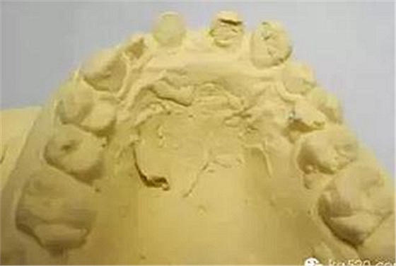 義齒加工技師想對醫(yī)生說的話 義齒加工技師想對醫(yī)生說的話