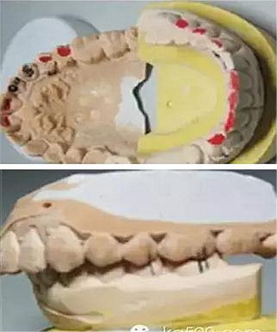 義齒加工技師想對醫(yī)生說的話 義齒加工技師想對醫(yī)生說的話