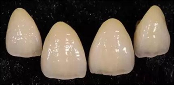 義齒加工技師想對醫(yī)生說的話 義齒加工技師想對醫(yī)生說的話