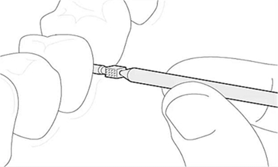 Icon 愛康滲透樹脂使用說明書 Icon 愛康滲透樹脂使用說明書