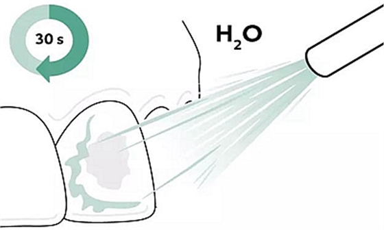 Icon 愛康滲透樹脂使用說明書 Icon 愛康滲透樹脂使用說明書
