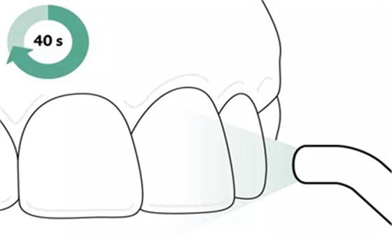 Icon 愛康滲透樹脂使用說明書 Icon 愛康滲透樹脂使用說明書