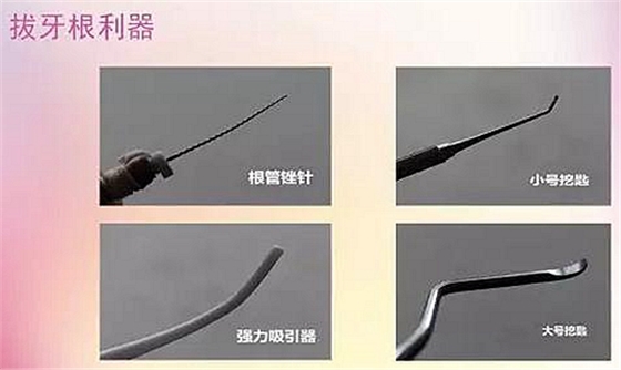 拔牙斷根的去與留？