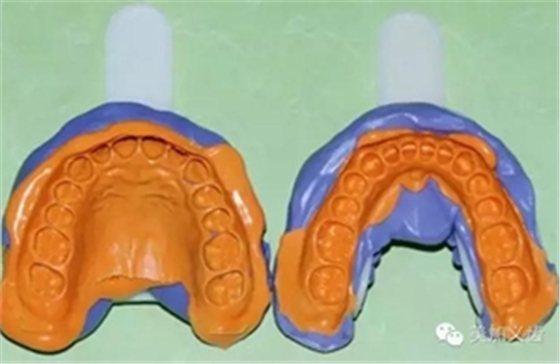 這10種情況下要重新取硅橡膠模型 這10種情況下要重新取硅橡膠模型