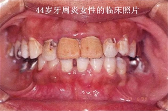 上海品瑞邁格磁致伸縮治療儀 上海品瑞邁格磁致伸縮治療儀