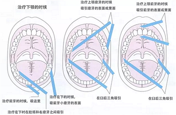 【齒科助手】診療時(shí)輔助基本 【齒科助手】診療時(shí)輔助基本