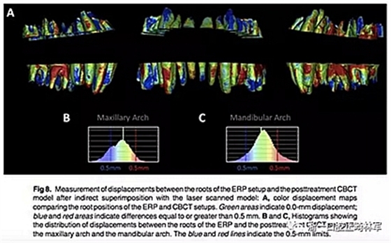 正畸文獻(xiàn)閱讀--正畸過(guò)程中牙根移動(dòng)的三維監(jiān)測(cè) 正畸文獻(xiàn)閱讀--正畸過(guò)程中牙根移動(dòng)的三維監(jiān)測(cè)