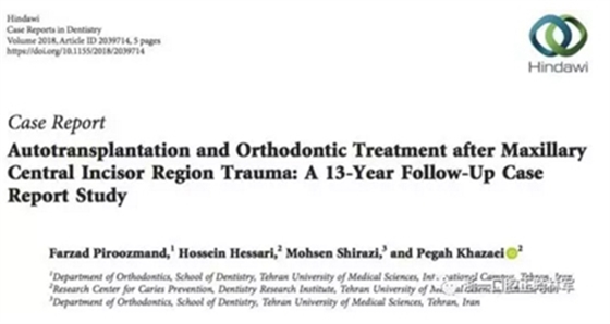 文獻(xiàn)優(yōu)秀正畸病例賞析--上頜中切牙區(qū)受傷后自體牙移植及正畸治療13年隨訪病例 文獻(xiàn)優(yōu)秀正畸病例賞析--上頜中切牙區(qū)受傷后自體牙移植及正畸治療13年隨訪病例