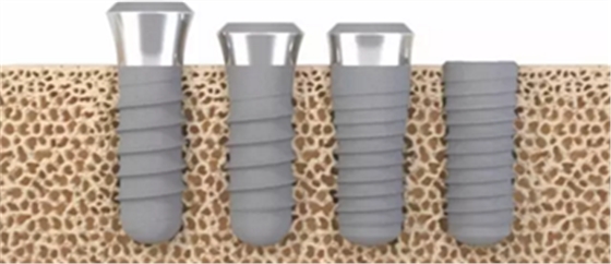 種植體，在全球牙科設(shè)備市場(chǎng)的變化！