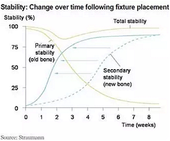 種植體，在全球牙科設(shè)備市場(chǎng)的變化！