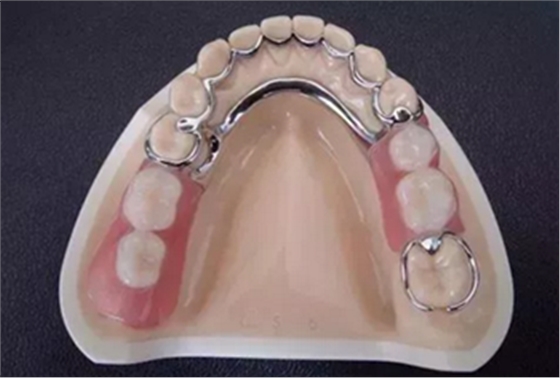 最可怕的牙病&mdash;&mdash;牙齦萎縮