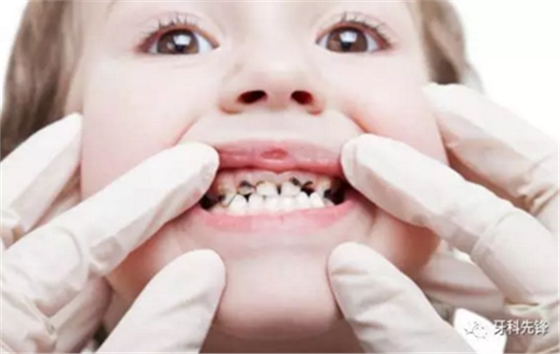 0~6歲寶寶口腔知識干貨集錦 0~6歲寶寶口腔知識干貨集錦
