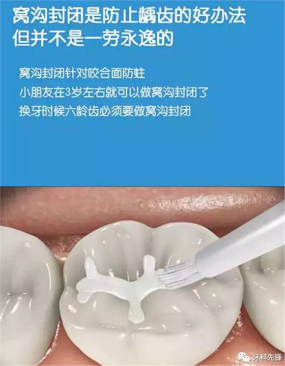 0~6歲寶寶口腔知識干貨集錦 0~6歲寶寶口腔知識干貨集錦