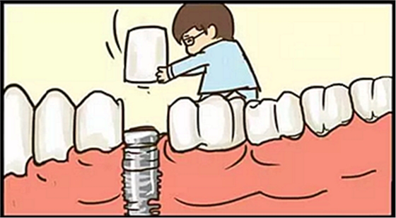 【牙齒種植】健康牙齒&ldquo;種&rdquo;出來