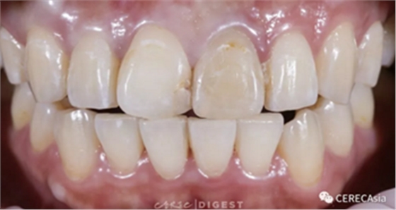 擁有瓷塊選擇權(quán)，是負(fù)擔(dān)還是自由？