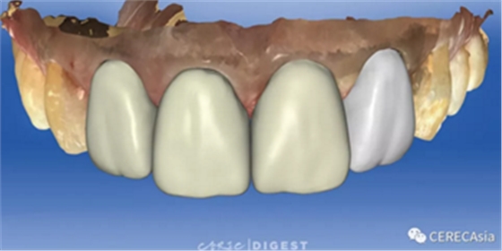 擁有瓷塊選擇權(quán)，是負(fù)擔(dān)還是自由？
