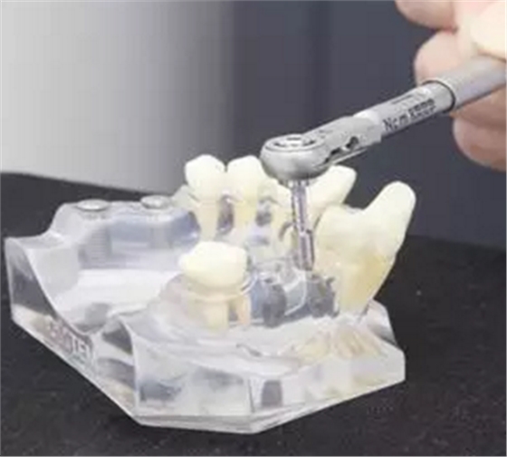牙技術(shù)丨牙科種植導(dǎo)板在臨床中的應(yīng)用 牙技術(shù)丨牙科種植導(dǎo)板在臨床中的應(yīng)用
