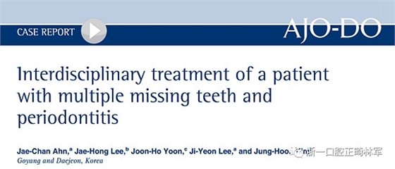 文獻優(yōu)秀正畸病例賞析--多顆牙齒缺失的牙周炎患者的跨學(xué)科綜合治療 文獻優(yōu)秀正畸病例賞析--多顆牙齒缺失的牙周炎患者的跨學(xué)科綜合治療