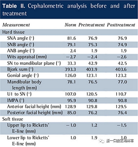 文獻優(yōu)秀正畸病例賞析--多顆牙齒缺失的牙周炎患者的跨學(xué)科綜合治療 文獻優(yōu)秀正畸病例賞析--多顆牙齒缺失的牙周炎患者的跨學(xué)科綜合治療