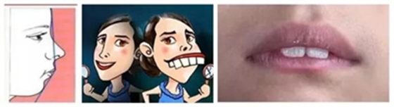 12歲前必須處理的20種兒童牙頜畸形【口腔科普】 12歲前必須處理的20種兒童牙頜畸形【口腔科普】