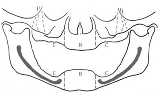 無牙頜種植修復(fù)的檢查與設(shè)計——施斌教授 無牙頜種植修復(fù)的檢查與設(shè)計——施斌教授