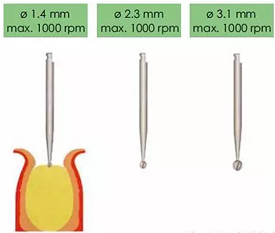 Sraumann種植系統(tǒng)外科操作流程