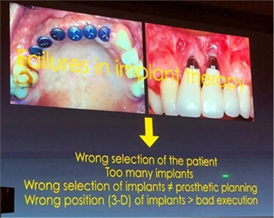 課堂筆記 | 看大師如何運(yùn)用數(shù)字化流程解決復(fù)雜病例