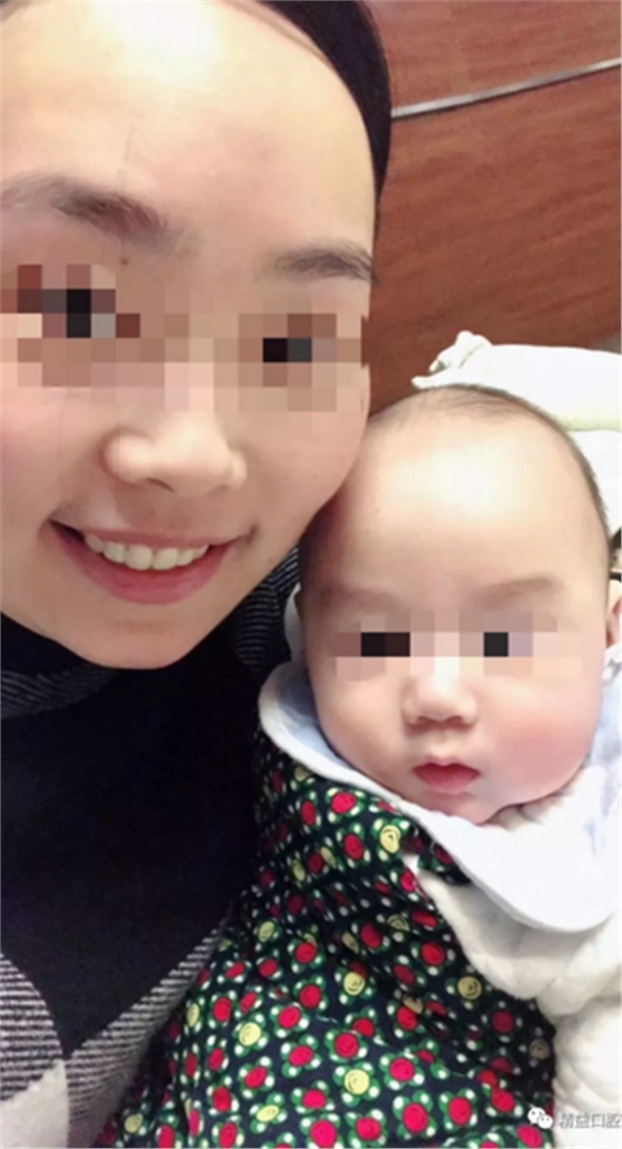 27歲嚴重齙牙，上下門牙牙根吸收嚴重，兩年矯正徹底蛻變，組建幸福家庭