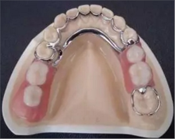 活動義齒的注意事項有哪些 活動義齒的注意事項有哪些