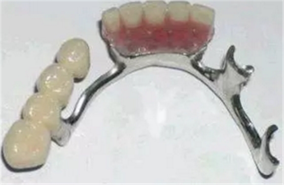 活動義齒的注意事項有哪些 活動義齒的注意事項有哪些