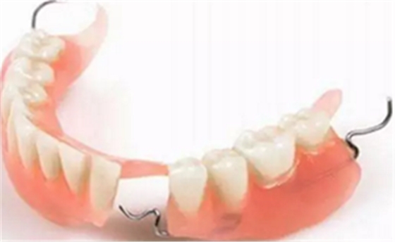 活動義齒的注意事項有哪些 活動義齒的注意事項有哪些