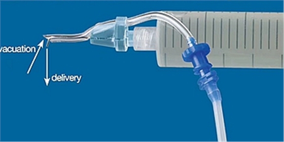 廣州蕙帆根管負壓系統(tǒng)