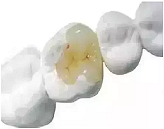 你總?cè)轮囱?ldquo;貴”還不是你自己造成的 你總?cè)轮囱?ldquo;貴”還不是你自己造成的