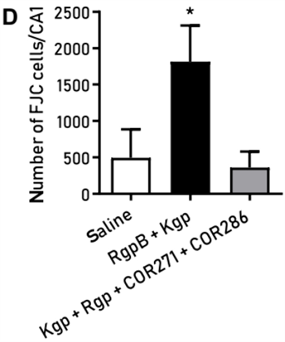 《科學(xué)》子刊：牙周炎細(xì)菌導(dǎo)致阿爾茨海默病實(shí)錘！科學(xué)家發(fā)現(xiàn)導(dǎo)致牙周炎的細(xì)菌能輕易侵入大腦，分泌有害蛋白誘發(fā)AD丨科學(xué)大發(fā)現(xiàn)