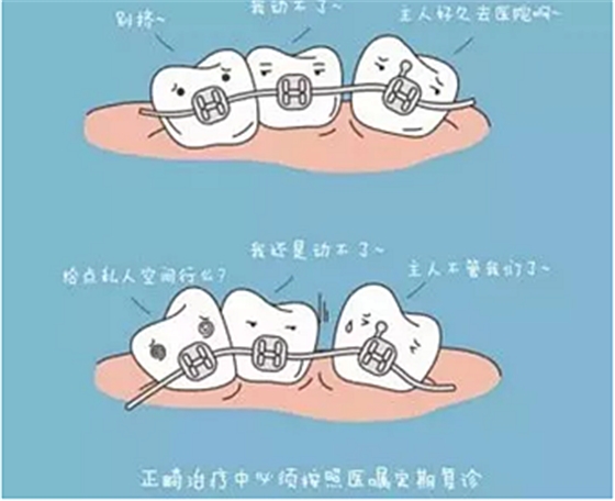 正畸需要注意些什么？