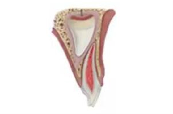 臨床實(shí)踐|乳牙外傷處理指引(值得兒牙醫(yī)生收藏) 臨床實(shí)踐|乳牙外傷處理指引(值得兒牙醫(yī)生收藏)