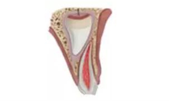 臨床實(shí)踐|乳牙外傷處理指引(值得兒牙醫(yī)生收藏) 臨床實(shí)踐|乳牙外傷處理指引(值得兒牙醫(yī)生收藏)