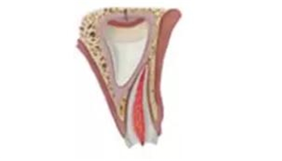 臨床實(shí)踐|乳牙外傷處理指引(值得兒牙醫(yī)生收藏) 臨床實(shí)踐|乳牙外傷處理指引(值得兒牙醫(yī)生收藏)