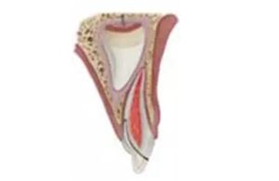 臨床實(shí)踐|乳牙外傷處理指引(值得兒牙醫(yī)生收藏) 臨床實(shí)踐|乳牙外傷處理指引(值得兒牙醫(yī)生收藏)