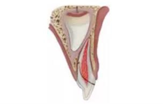 臨床實(shí)踐|乳牙外傷處理指引(值得兒牙醫(yī)生收藏) 臨床實(shí)踐|乳牙外傷處理指引(值得兒牙醫(yī)生收藏)