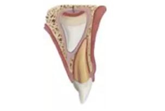 臨床實(shí)踐|乳牙外傷處理指引(值得兒牙醫(yī)生收藏) 臨床實(shí)踐|乳牙外傷處理指引(值得兒牙醫(yī)生收藏)